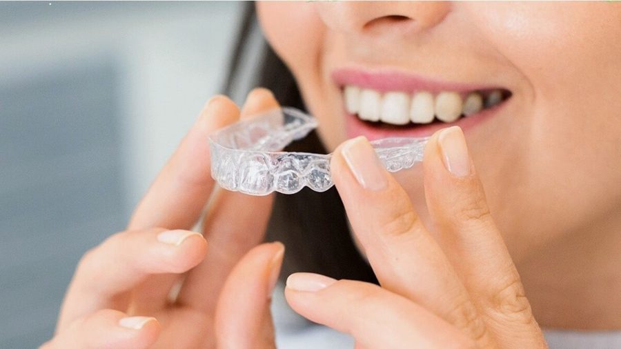 Ortodoncia invisible: Alineadores transparentes y extraíbles